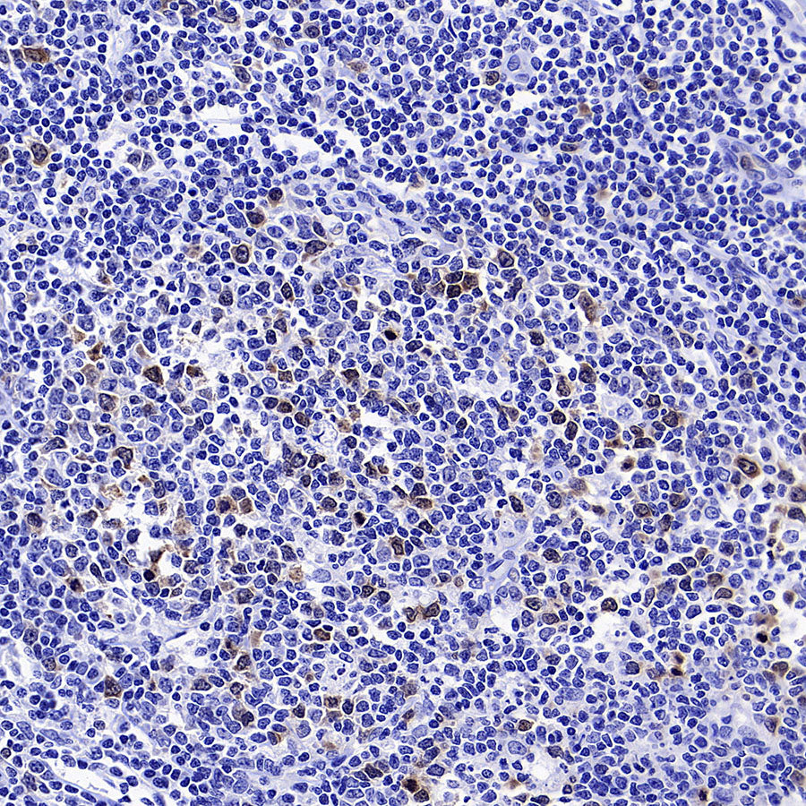 Aurora A Recombinant Rabbit mAb (S-5355)