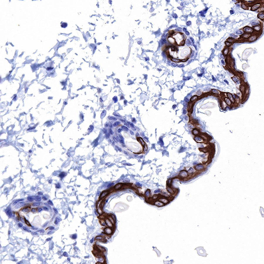 Keratin 10 Recombinant Rabbit mAb (SDT-124-6)