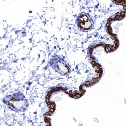 Keratin 10 Recombinant Rabbit mAb (SDT-124-6)