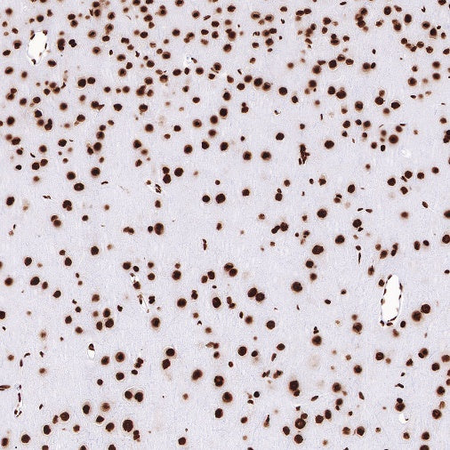 TDP43 Recombinant Rabbit mAb (S-R354)