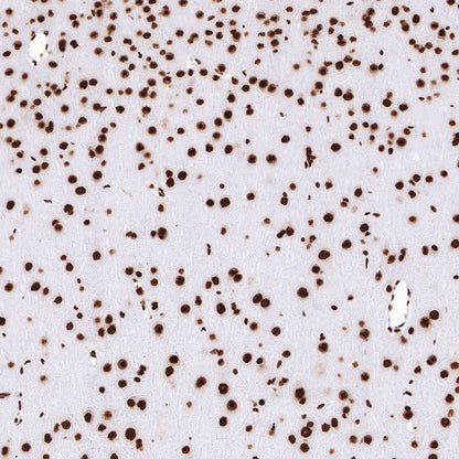 TDP43 Recombinant Rabbit mAb (S-R354)