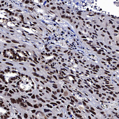 RPA3 Recombinant Rabbit mAb (S-4552-20)
