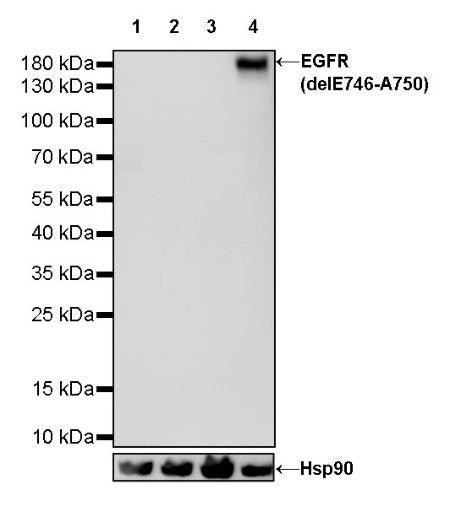 EGFR (delE746-A750) Recombinant Rabbit mAb (S-451-168)