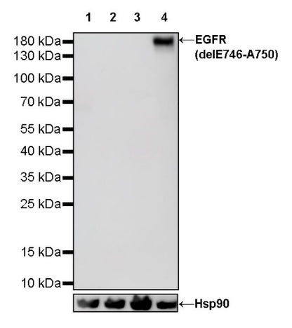 EGFR (delE746-A750) Recombinant Rabbit mAb (S-451-168)