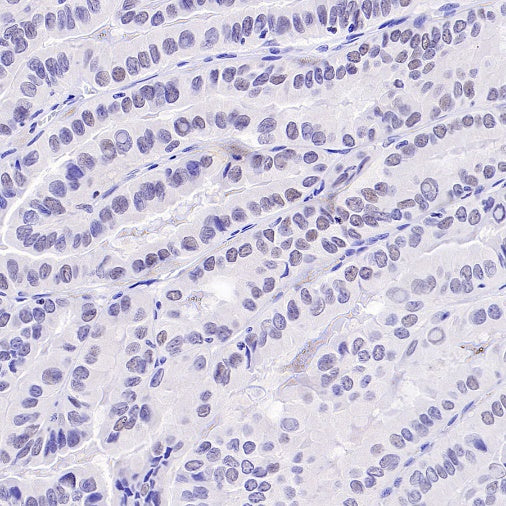 TCF1/TCF7 Recombinant Rabbit mAb (S-3486)
