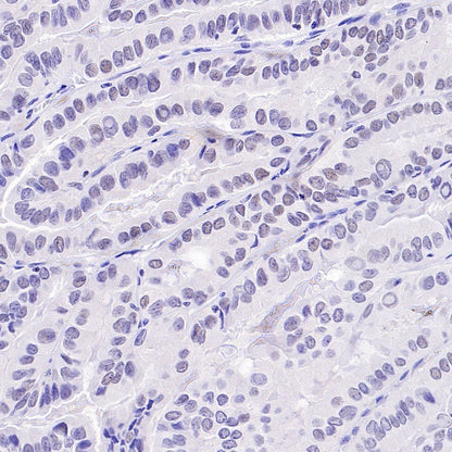 TCF1/TCF7 Recombinant Rabbit mAb (S-3486)