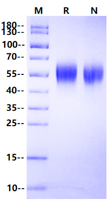 IL-2 Rγ/CD132 His Tag Protein, Human