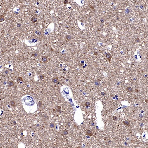 CaMKII alpha Recombinant Rabbit mAb (S-2451-54)