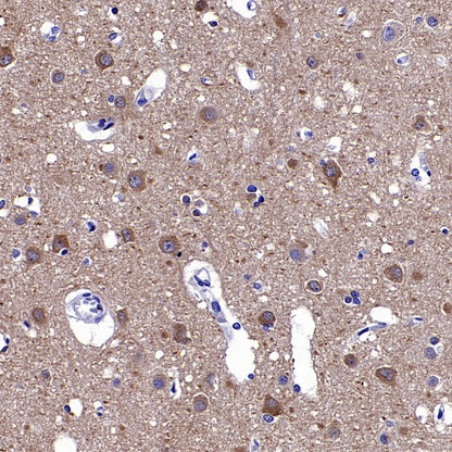 CaMKII alpha Recombinant Rabbit mAb (S-2451-54)