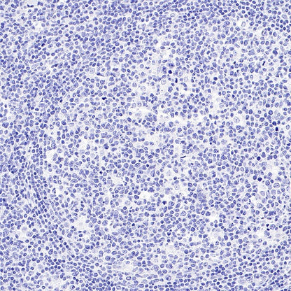 Mouse mAb IgG2b, κ Isotype Control (S-844-22)