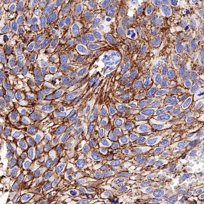 Claudin 4 Recombinant Rabbit mAb (SDT-814-53)