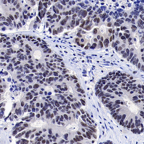MLH1 Recombinant Mouse mAb,PBS Only (SDT-R702)
