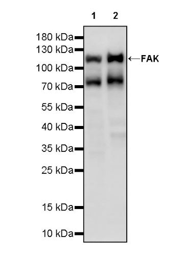 FAK Recombinant Rabbit mAb (S-1180-10)