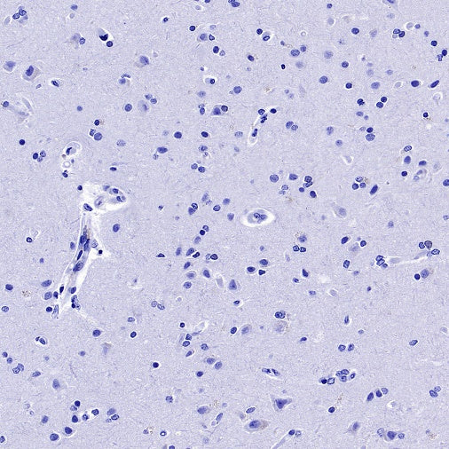 Myelin protein zero Recombinant Rabbit mAb (SDT-1225-8)