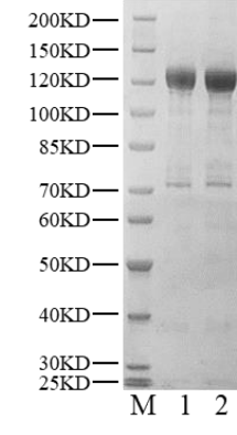 ABL Protein, Human