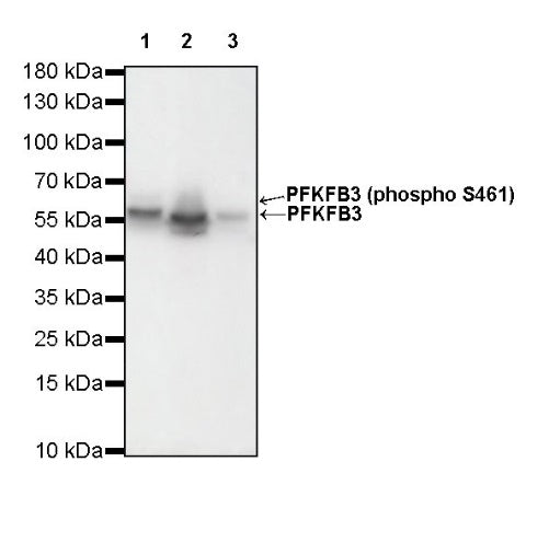 PFKFB3 Recombinant Rabbit mAb (S-653-35)