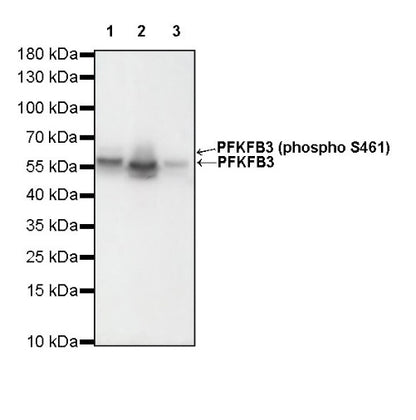 PFKFB3 Recombinant Rabbit mAb (S-653-35)