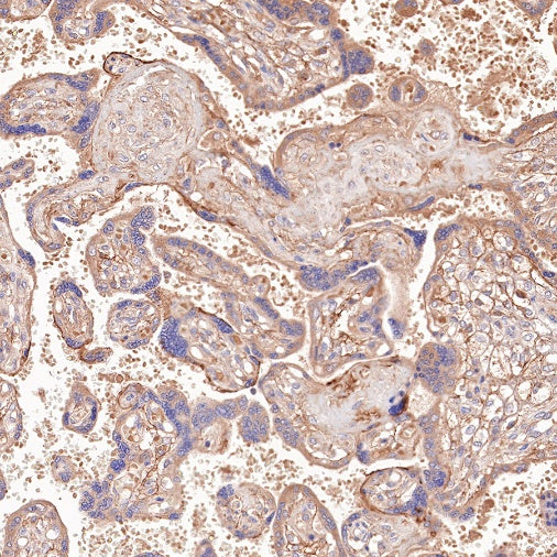 PI3 Kinase p85 Recombinant Rabbit mAb (SDT-R108)