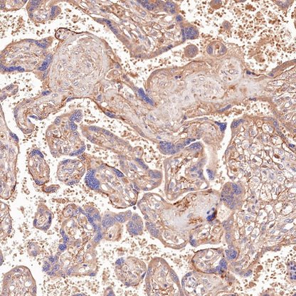 PI3 Kinase p85 Recombinant Rabbit mAb (SDT-R108)