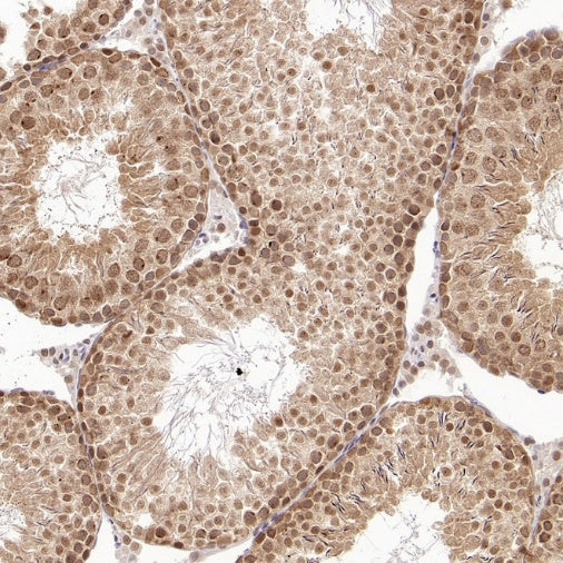 XPO1/CRM1 Recombinant Rabbit mAb (S-3309-7)