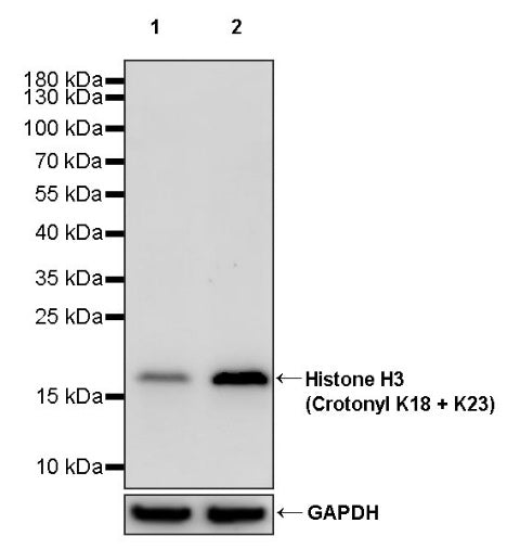 Histone H3 (Crotonyl K18 + K23) Recombinant Rabbit mAb (S-R410)