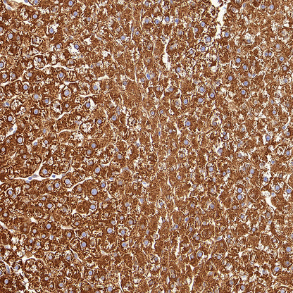 P4HB Recombinant Rabbit mAb