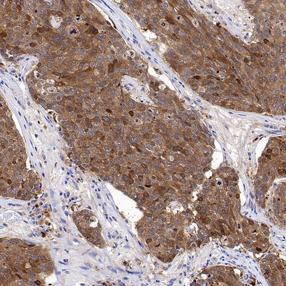 14-3-3 sigma Rabbit Polyclonal Antibody