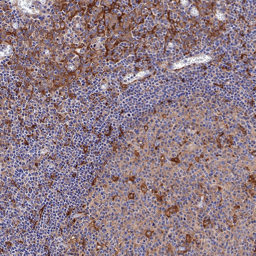 Atg7 Recombinant Rabbit mAb (S-R302)
