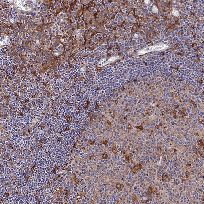 Atg7 Recombinant Rabbit mAb (S-R302)