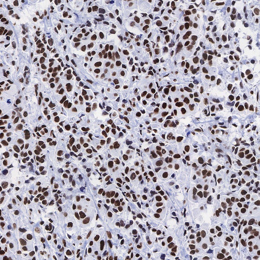 Histone H3 (acetyl K9) Rabbit polyclonal antibody
