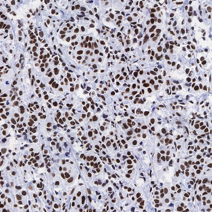 Histone H3 (acetyl K9) Rabbit polyclonal antibody