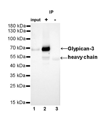 Glypican-3 Recombinant Rabbit mAb,PBS Only (SDT-R032)