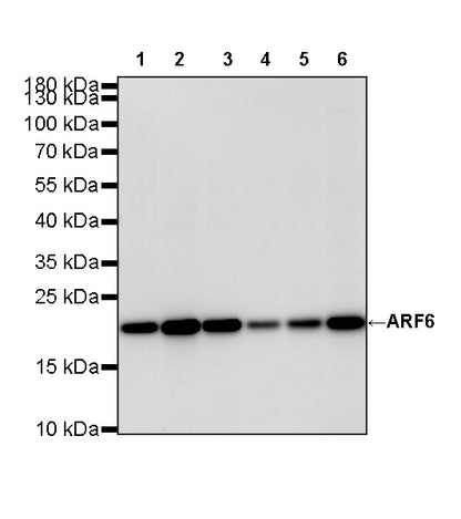 ARF6 Recombinant Rabbit mAb (S-4283-62)