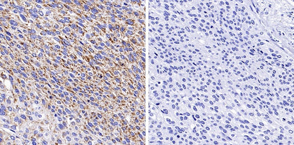 Phospho-PDHA1 (S293) Recombinant Rabbit mAb (S-1729-25)