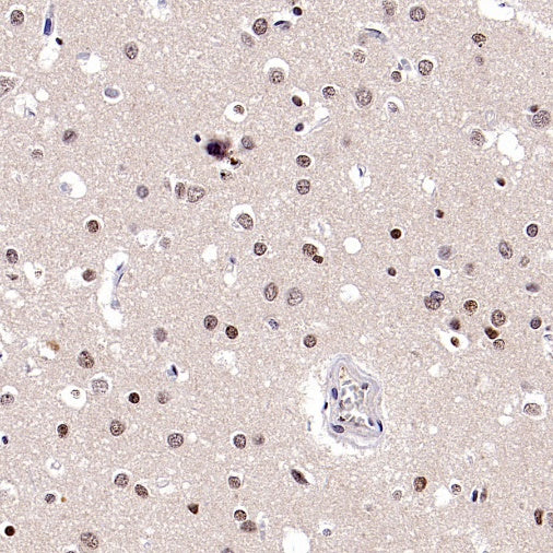 FOXM1 Recombinant Rabbit mAb (S-2529-26)