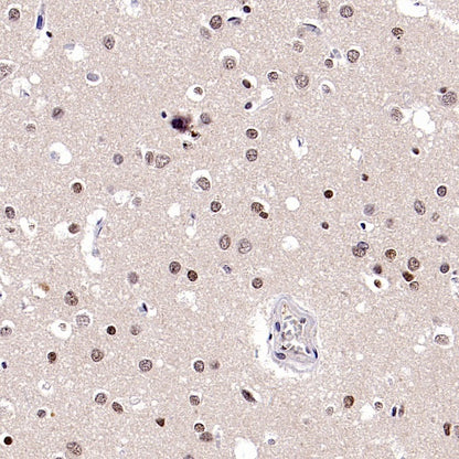 FOXM1 Recombinant Rabbit mAb (S-2529-26)