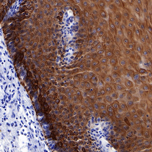 Keratin 16 Recombinant Rabbit mAb (S-R306)