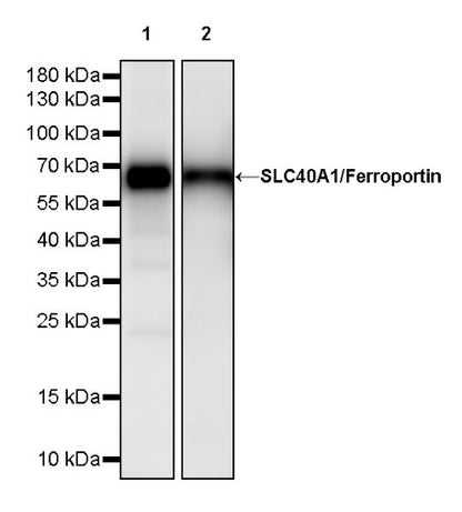 SLC40A1/Ferroportin Recombinant Rabbit mAb (S-2172-35)