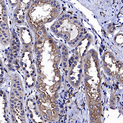 CD64 Recombinant Mouse mAb (S-5504)