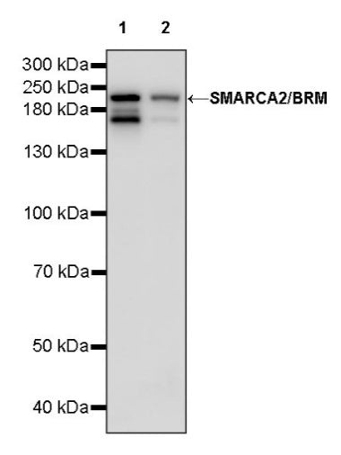 SMARCA2/BRM Recombinant Rabbit mAb (S-1568-17)