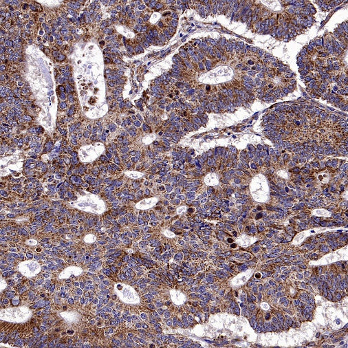 VDAC2 Rabbit Polyclonal Antibody