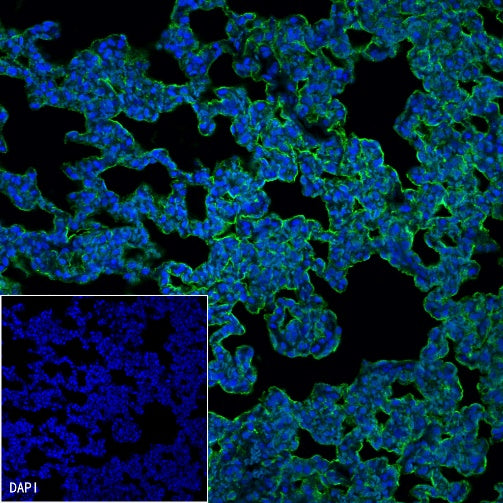 Aquaporin 5/AQP5 Recombinant Rabbit mAb (S-1610-43)