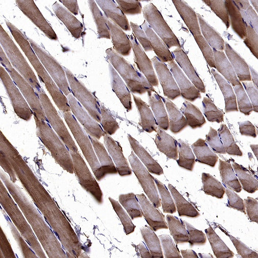 AGTR1 Recombinant Rabbit mAb (S-2447-22)