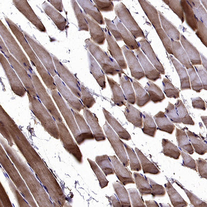 AGTR1 Recombinant Rabbit mAb (S-2447-22)