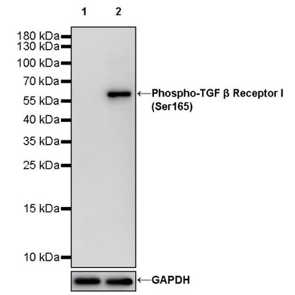 Phospho-TGF β Receptor I(Ser165) Recombinant Rabbit mAb (S-1896-21)