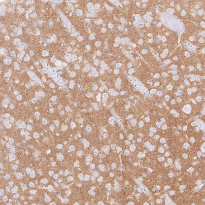 Homer1 Recombinant Rabbit mAb (S-3405-360)
