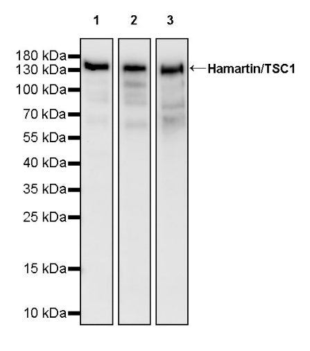 Hamartin/TSC1 Recombinant Rabbit mAb (S-2725-166)