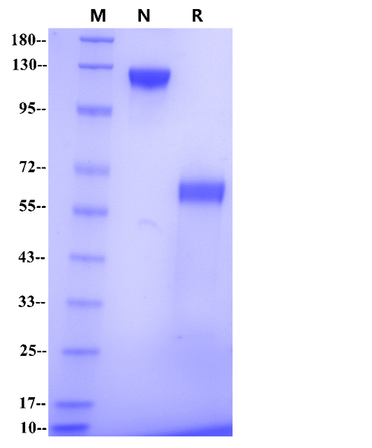 Siglec-15 mFc Chimera Protein, Human
