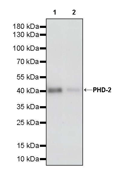PHD-2 Recombinant Rabbit mAb (S-4111-17)