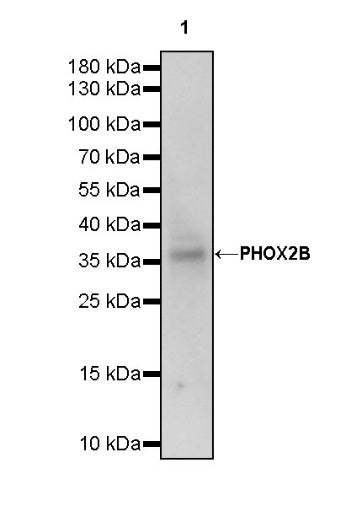 PHOX2B Recombinant Rabbit mAb (SDT-1142-21)